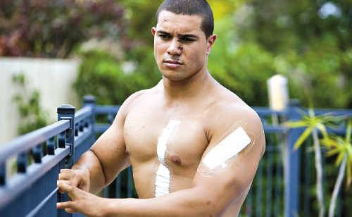 Jesse Palu went through four hours of surgery after he was allegedly cut with a broken beer bottle at a Fortitude Valley night club. Jesse Palu went through four hours of surgery after he was allegedly cut with a broken beer bottle at a Fortitude Valley night club.